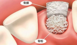 佛山种牙爆料事件最新情况,最新进展与各方回应梳理